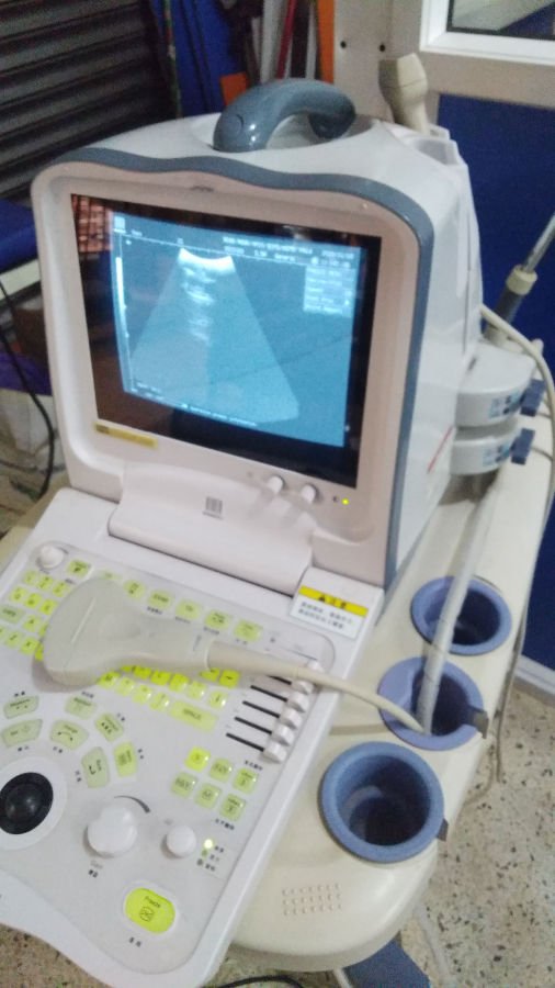 Ultrasound Scan Machine Supplier in Uganda