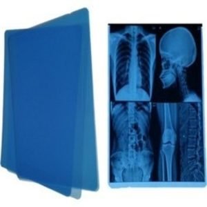 X-ray Film on Sale at our showroom located on Arua Park Plaza Building at God's Grace Biomed Supply limited in Kampala.